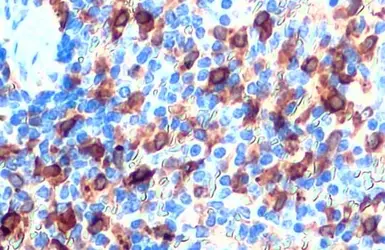 Anti-Heme Oxygenase 1 antibody [HL1780] used in IHC (Paraffin sections) (IHC-P). GTX637432
