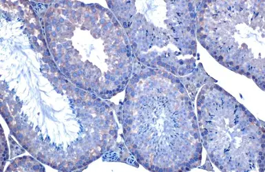 Anti-HSC70 antibody [HL1788] used in IHC (Paraffin sections) (IHC-P). GTX637440