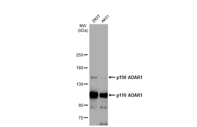 Anti-ADAR1 antibody [HL1789] used in Western Blot (WB). GTX637441