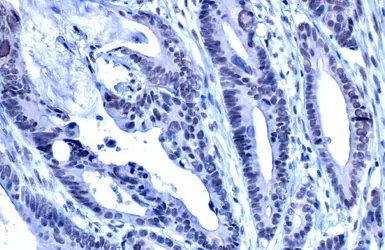 Anti-ADAR1 antibody [HL1789] used in IHC (Paraffin sections) (IHC-P). GTX637441