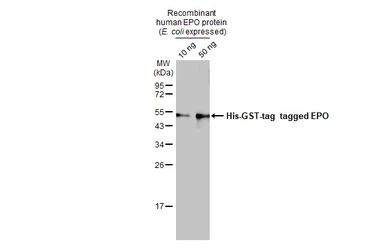 Anti-EPO antibody [HL1794] used in Western Blot (WB). GTX637446