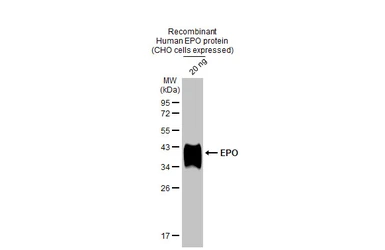 Anti-EPO antibody [HL1794] used in Western Blot (WB). GTX637446