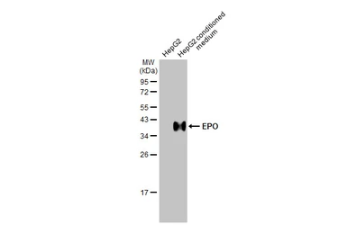 Anti-EPO antibody [HL1794] used in Western Blot (WB). GTX637446