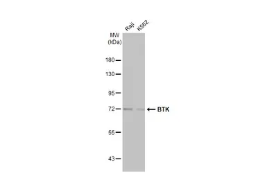 Anti-BTK antibody [HL1803] used in Western Blot (WB). GTX637455