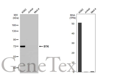 Anti-BTK antibody [HL1803] used in Western Blot (WB). GTX637455