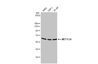 Anti-METTL14 antibody [HL1816] used in Western Blot (WB). GTX637541