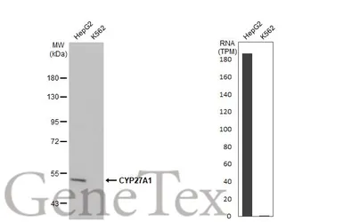 Anti-CYP27A1 antibody [HL1820] used in Western Blot (WB). GTX637545