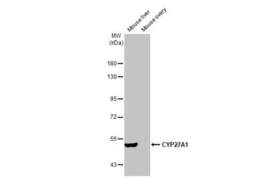Anti-CYP27A1 antibody [HL1820] used in Western Blot (WB). GTX637545