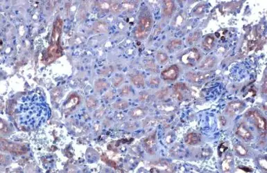 Anti-CYP27A1 antibody [HL1820] used in IHC (Paraffin sections) (IHC-P). GTX637545