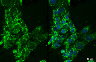 Anti-CYP27A1 antibody [HL1820] used in Immunocytochemistry/ Immunofluorescence (ICC/IF). GTX637545
