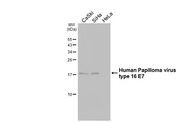 Anti-Human Papillomavirus type 16 E7 antibody [HL1821] used in Western Blot (WB). GTX637546