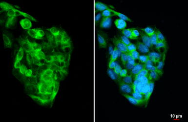 Anti-Prealbumin antibody [HL1823] used in Immunocytochemistry/ Immunofluorescence (ICC/IF). GTX637548