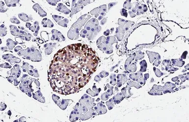 Anti-Prealbumin antibody [HL1823] used in IHC (Paraffin sections) (IHC-P). GTX637548