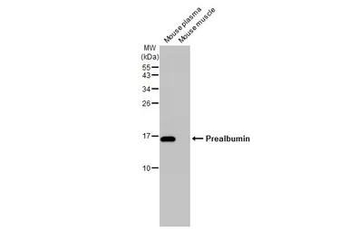 Anti-Prealbumin antibody [HL1823] used in Western Blot (WB). GTX637548