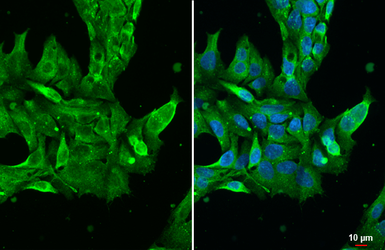 Anti-Prealbumin antibody [HL1823] used in Immunocytochemistry/ Immunofluorescence (ICC/IF). GTX637548
