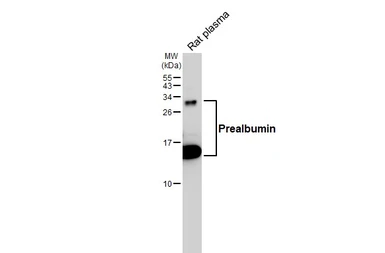 Anti-Prealbumin antibody [HL1823] used in Western Blot (WB). GTX637548