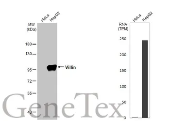 Anti-Villin antibody [HL1830] used in Western Blot (WB). GTX637555