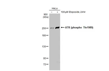 Anti-ATR (phospho Thr1989) antibody [HL1835] used in Western Blot (WB). GTX637560
