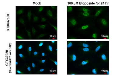 Anti-ATR (phospho Thr1989) antibody [HL1835] used in Immunocytochemistry/ Immunofluorescence (ICC/IF). GTX637560