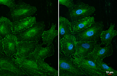 Anti-MLKL antibody [HL1849] used in Immunocytochemistry/ Immunofluorescence (ICC/IF). GTX637574