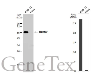 Anti-TRIM72 antibody [HL1855] used in Western Blot (WB). GTX637580