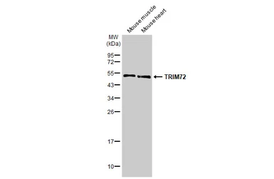 Anti-TRIM72 antibody [HL1855] used in Western Blot (WB). GTX637580