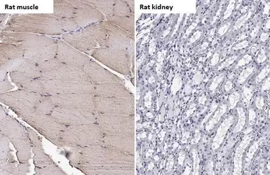 Anti-TRIM72 antibody [HL1855] used in IHC (Paraffin sections) (IHC-P). GTX637580