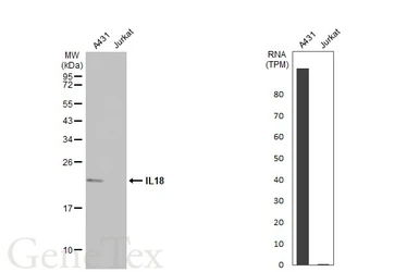Anti-IL18 antibody [HL1859] used in Western Blot (WB). GTX637584