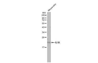 Anti-IL18 antibody [HL1859] used in Western Blot (WB). GTX637584