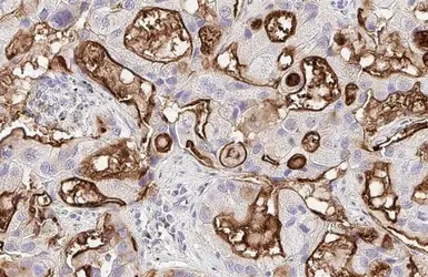 Anti-GPRC5A antibody [HL1864] used in IHC (Paraffin sections) (IHC-P). GTX637589