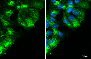 Anti-GPRC5A antibody [HL1864] used in Immunocytochemistry/ Immunofluorescence (ICC/IF). GTX637589