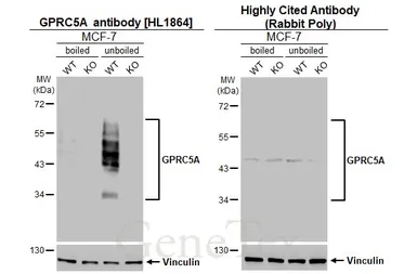 Anti-GPRC5A antibody [HL1864] used in Western Blot (WB). GTX637589