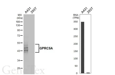Anti-GPRC5A antibody [HL1864] used in Western Blot (WB). GTX637589