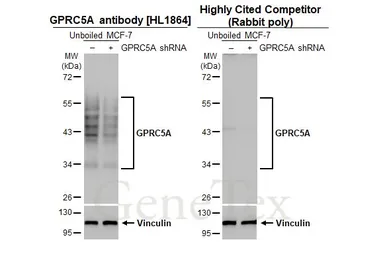 Anti-GPRC5A antibody [HL1864] used in Western Blot (WB). GTX637589