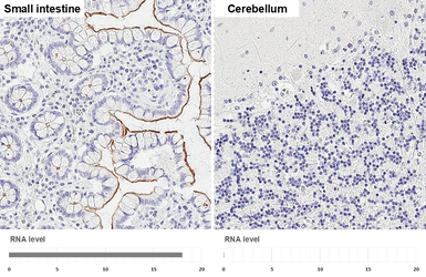 Anti-GPRC5A antibody [HL1864] used in IHC (Paraffin sections) (IHC-P). GTX637589