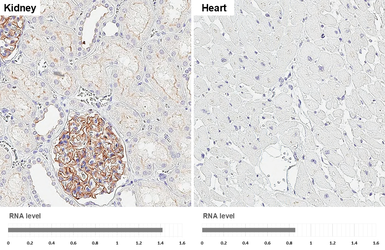 Anti-GPRC5A antibody [HL1864] used in IHC (Paraffin sections) (IHC-P). GTX637589