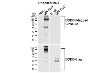Anti-GPRC5A antibody [HL1864] used in Western Blot (WB). GTX637589