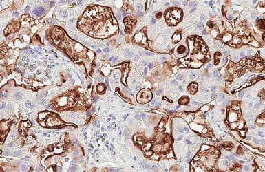 Anti-GPRC5A antibody [HL1864] used in IHC (Paraffin sections) (IHC-P). GTX637589