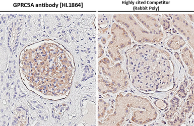 Anti-GPRC5A antibody [HL1864] used in IHC (Paraffin sections) (IHC-P). GTX637589