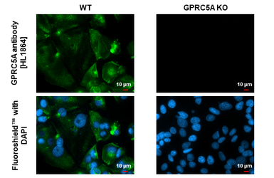 Anti-GPRC5A antibody [HL1864] used in Immunocytochemistry/ Immunofluorescence (ICC/IF). GTX637589