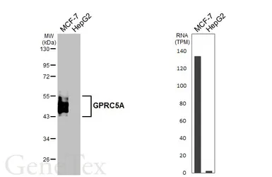 Anti-GPRC5A antibody [HL1864] used in Western Blot (WB). GTX637589