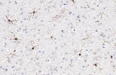 Anti-Iba1 antibody [HL1880] used in IHC (Paraffin sections) (IHC-P). GTX637629