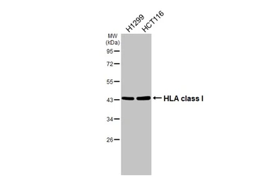 Anti-HLA class I antibody [HL1882] used in Western Blot (WB). GTX637631