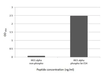 Anti-IRE1 alpha (phospho Ser724) antibody [HL1885] used in  (). GTX637634