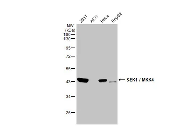 Anti-SEK1 / MKK4 antibody [HL1888] used in Western Blot (WB). GTX637637