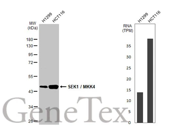Anti-SEK1 / MKK4 antibody [HL1888] used in Western Blot (WB). GTX637637