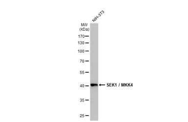 Anti-SEK1 / MKK4 antibody [HL1888] used in Western Blot (WB). GTX637637