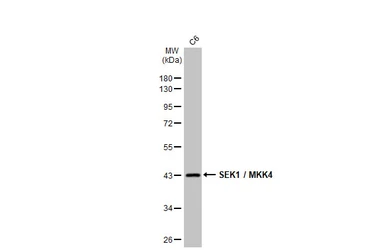 Anti-SEK1 / MKK4 antibody [HL1888] used in Western Blot (WB). GTX637637