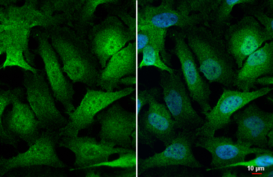 Anti-SEK1 / MKK4 antibody [HL1888] used in Immunocytochemistry/ Immunofluorescence (ICC/IF). GTX637637