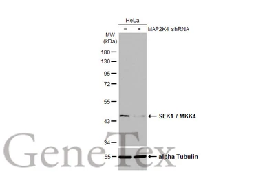 Anti-SEK1 / MKK4 antibody [HL1888] used in Western Blot (WB). GTX637637